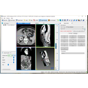 Segmentation panel megjelenítve. Adjunk hozzá új szegmentálást.