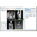 Válasszuk a 3D küszöbölés eszközt.