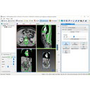 Állítsuk be a 300-as küszöbértéket, és fogadjuk el.