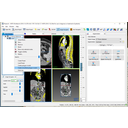 Generáljunk felszínmodellt a szegmentálásból.